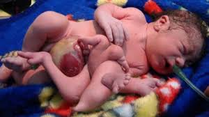 Image result for radiation sickness