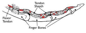 This strain can cause unwanted pain and stress. Flexor Tendon Injuries Orthoinfo Aaos