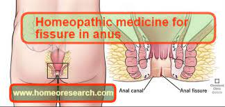 Emuaid.com has been visited by 100k+ users in the past month Homeopathic Medicine For Fissure In Anus Homeoresearch Com