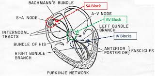 Locations Of Conduction Abnormalities Frank G Yanowitz M D Anatomy And Physiology Cardiology Cardiac