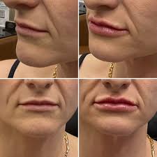 Shoutout to Wanda for this amazing review! We love helping our clients feel  informed, confident, and excited about their treatments. Christina always  goes above and beyond to make sure you get