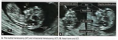 Image result for First Trimester Education