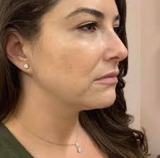 Black Diamond Rejuvenation Center