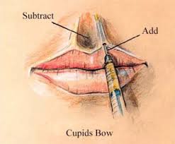 Valentine Mouth Rejuvenation Panama City Lip Rejuvenation Destin Florida Lip Augmentation Fl Facial Aesthetics Facial Fillers Lip Injections