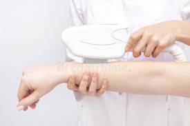 (this will allow the laser treatment. Laser Hair Removal The Girl Removes Hair With A Laser On Her Arm In A Spa Salon Stock Image Image Of Laser Girl 167614711