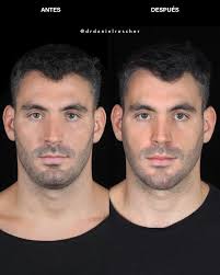 Daniel Roscher Ortognática Maxilofacial