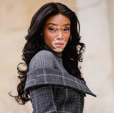 Download Model Winnie Harlow Isn T A Vitiligo Sufferer