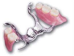 Check spelling or type a new query. Dr Qaseh Gigi Palsu Krom Kobalt Cobalt Chrome Dentures Ini Adalah Sejenis Gigi Palsu Yang Mempunyai Tapak Metal Sebagai Kerangkanya Gigi Palsu Akrilik Akan Dilekatkan Ke Atasnya Dengan Bahan Akrilik