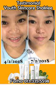 Kandungan ekstrak lidah buayanya akan melembabkan kulit, sedangkan kandungan ekstrak semua jenis produk perawatan wajah dari wardah memang dibuat untuk membuat kulit wajah sehat dan bersinar. Produk Paling Berkesan Untuk Memutihkan Kulit Pemutih Kulit Pemutih Produk