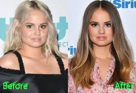 Debby Ryan Plastic Surgery Did You Really Need It Debby Plastic Surgery Celebrity Plastic Surgery Debby Ryan