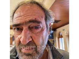 Golpea Rogelio Ramos a Gil Cuevas por solicitar transparencia en la  elección de la Canaco