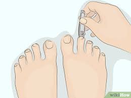 Image result for Onycholysis feet