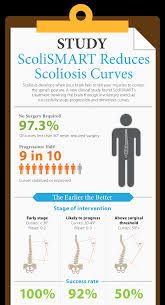 The 5 Most Common Symptoms Of Scoliosis How To Intervene