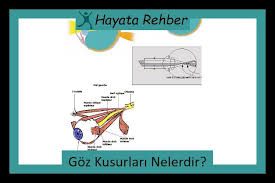 Goz Kusurlari Nelerdir Rehber Gozler Egitim