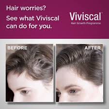 Viviscal helps prolong the growth stage, by supplying your hair with nutrients. Viviscal Ireland Real Women S Healthier Hair Growth Results Charley Facebook