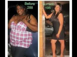 Before And After Gastric Sleeve Weight Loss Journey Lapband Revision Ab Workouts Metabolic Diet Weight Loss Weight Loss Journey