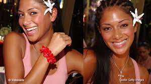 Nicole scherzinger (34) eiferte vor einigen jahren ihrem vorbild jennifer lopez (43) nach. Nicole Scherzinger Hat Hier Etwa Der Beauty Doc Nachgeholfen