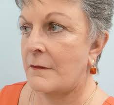 Arrowhead Plastic Surgery