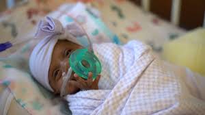 If your baby is born premature, there are certain things that can affect his or her health, learning, and your family's schedule. World S Smallest Surviving Premature Baby Released From Us Hospital Bbc News