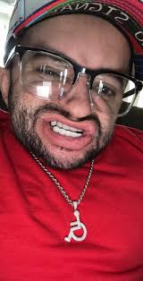 Brittle Bone Disease