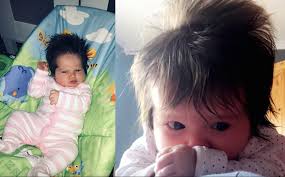 Some babies are born with a soft, fine hair on their shoulders and back, called lanugo. Baby Born With Amazing Head Of Hair After It Was So Thick It Was Spotted On The Scan