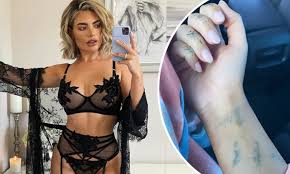 The model was a late arrival to the villa back in 2018, and. Megan Barton Hanson Shows Off Results Of Huge Laser Tattoo Removal Daily Mail Online