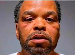 Look like #MethodMan got his face rocked! Eyes all puffed! TICAL! 😂  #allegedly