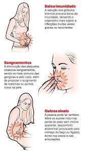 Maybe you would like to learn more about one of these? Conheca Quais Sao Os Sintomas Da Leucemia Cancer Que Atinge Principalmente Criancas Saude E Ciencia Extra Online