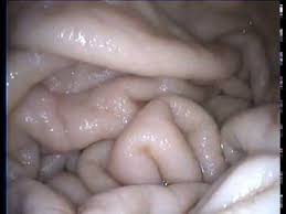 Maybe you would like to learn more about one of these? Download Vore Endoscope Fish 3gp Mp4 Mp3 Flv Webm Pc Mkv Irokotv Ibakatv Soundcloud