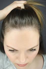 Have you recently had a baby? How I Grew My Hair Back Post Partum Naturally And In One Month Justina S Gems
