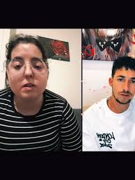 Craniosténose Morgane