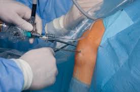 Arthroskopie Gelenk Klinik De