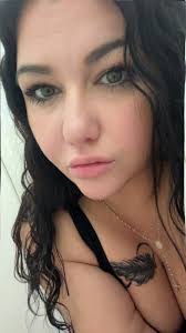 When can you start having a drink (alcoholic) here and there ? I like the  occasional white claw at gatherings doctor told me 4 weeks min for the  occasional drink but I'm