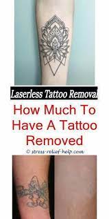 Looking for the very best laser tattoo removal clinic in melbourne? Laser Tattoo Removal Price How To Remove An Unhealed Tattoo What Removes Tempo Laser Half Sleeve Tattoo Tattoo Kits Laser Tattoo Removal