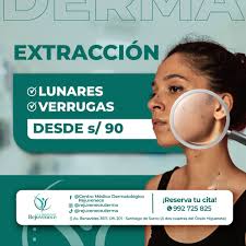 💥 Despídete de los lunares y verrugas de manera segura y efectiva 💥 👉  Extracción desde S/90 con tecnología de vanguardia y especialistas en  dermatología. ✨ Beneficios: ✓ Procedimiento rápido y seguro