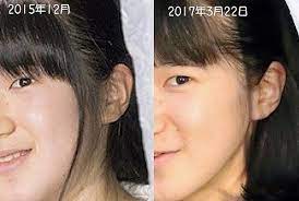 本物の愛子さまであることを証明する難しさ これでいいのだ日記part2 笑える顔 愛子様 有名人の整形手術