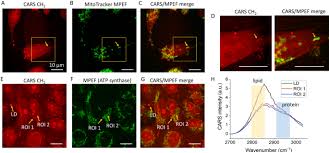 Consider this animal cell which organelles are labeled d and what is one feature. Tracking The Formation And Degradation Of Fatty Acid Accumulated Mitochondria Using Label Free Chemical Imaging Scientific Reports