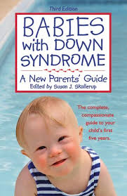 Babies With Down Syndrome A New Parent S Guide Down Syndrome Baby Down Syndrome Parenting Guide