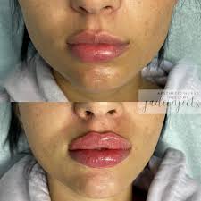 Jade Concepcion BSN, RN. 💉