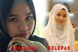 Jerawat adalah salah satu masalah terbesar pada kulit, terlebih untuk seseorang yang memiliki jenis kulit yang berminyak. Murung Lepas Muka Breakout 6 Produk Drugstore Pulihkan Jerawat Farah