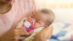 Simak penjelasan selengkapnya berikut ini. Penyakit Pneumonia Jangkitan Kuman Paru Paru Pada Bayi Yang Boleh Bawa Maut