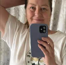 I've been seeing this sickly coyote every day lately off 17th and Whittier.  Yesterday it approached me as i was getting in my car. Be careful!