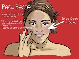 6 Astuces Contre La Peau Seche Astuces De Grand Mere Peau Seche Visage Peau Seche Peau