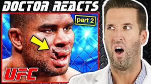 Doctor Reacts to Chris Weidman Shattered BROKEN Leg at UFC 261