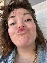 So my daughter was diagnosed with adhd today I'm overwhelmed and this may  seem a silly question but what do I do now who do I.update ect tia