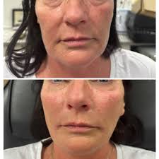 Signature Brows & Aesthetics