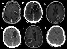 Pin On Radiology Signs