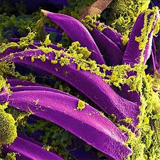 Image result for Rhizobium radiobacter, syn. Agrobacterium tumefaciens