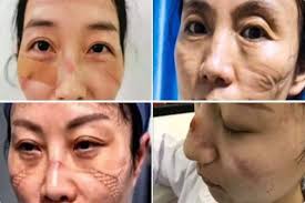 Nurses Take Off Their Masks After Treating Coronavirus Patients