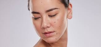 Expert Dermatologists In Cambridge